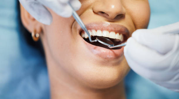 Best Emergency Broken Tooth Repair in Daniels Farm, CT